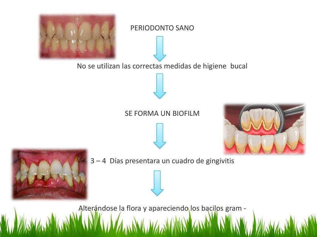 No se utilizan las correctas medidas de higiene bucal