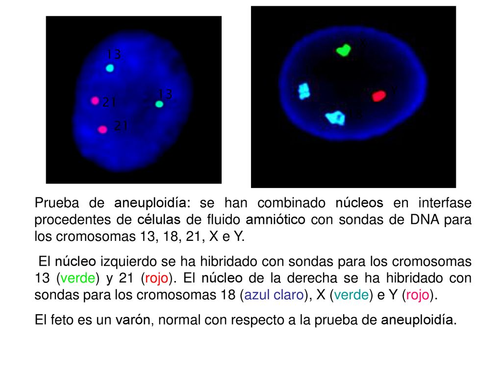 El feto es un varón, normal con respecto a la prueba de aneuploidía.