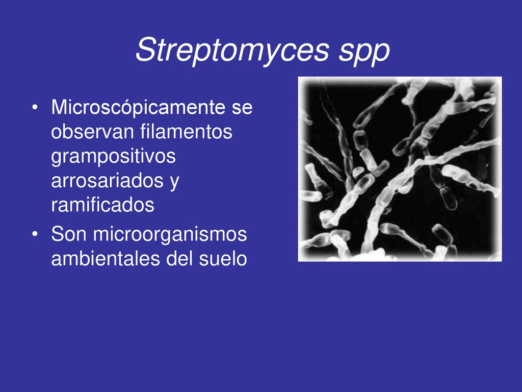 Streptomyces spp Microscópicamente se observan filamentos grampositivos arrosariados y ramificados.