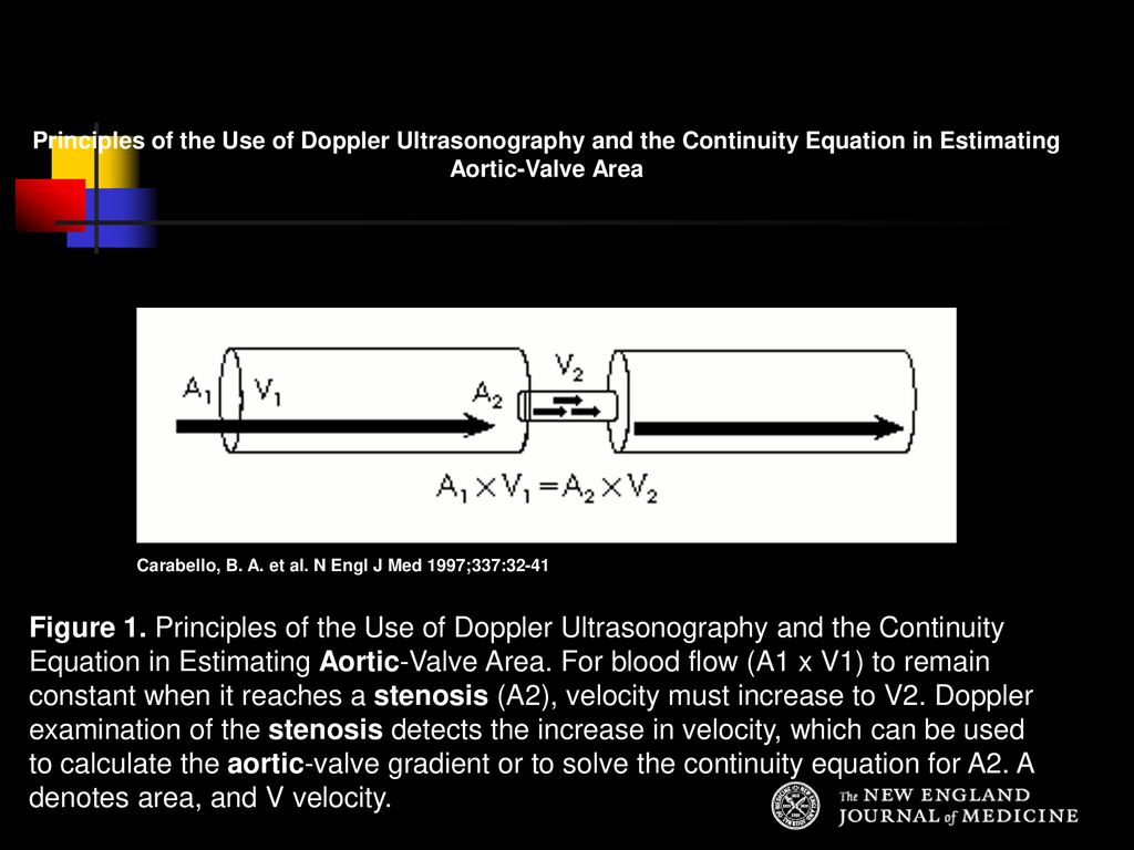 Principles of the Use of Doppler Ultrasonography and the Continuity Equation in Estimating Aortic-Valve Area