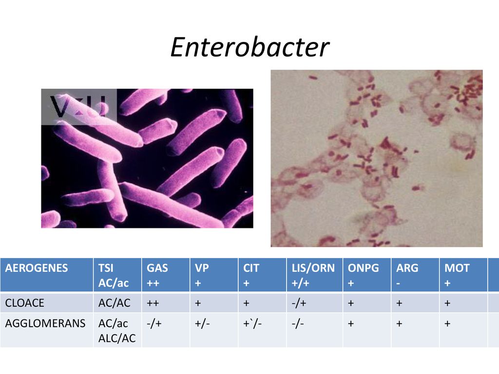 Enterobacter AEROGENES TSI AC/ac GAS ++ VP + CIT LIS/ORN +/+ ONPG ARG