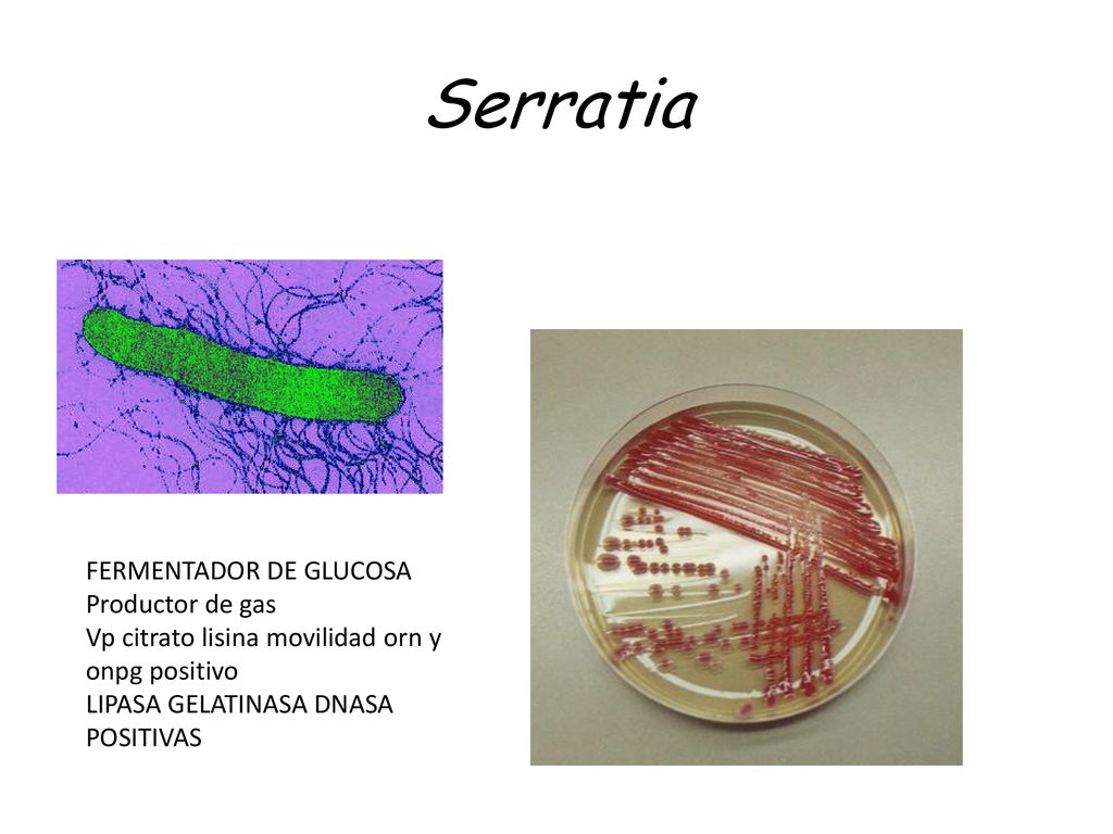Serratia FERMENTADOR DE GLUCOSA Productor de gas