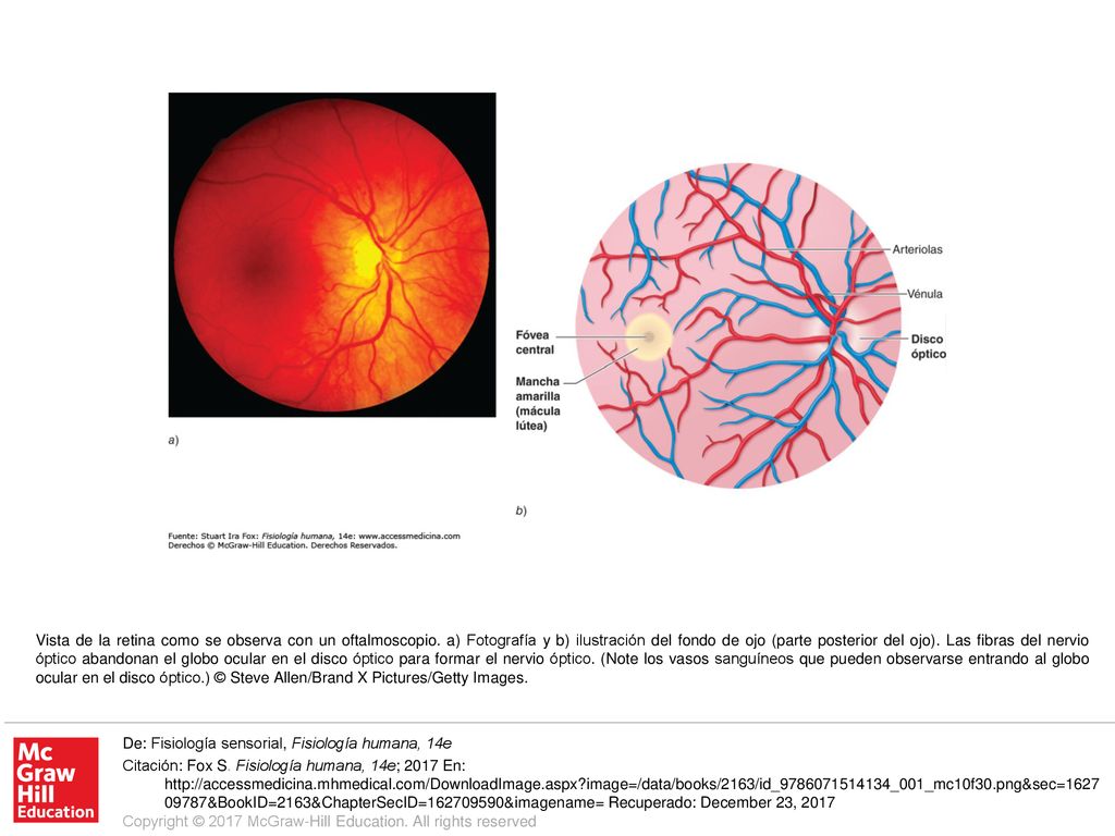 Vista de la retina como se observa con un oftalmoscopio