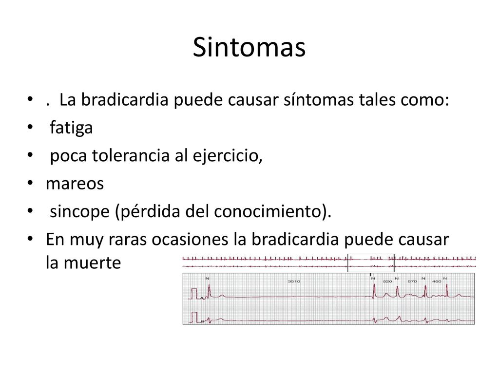 Sintomas . La bradicardia puede causar síntomas tales como: fatiga