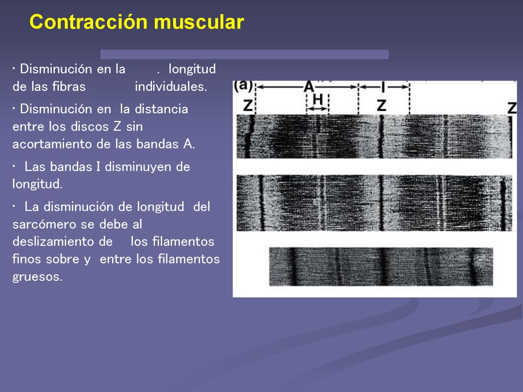 Contracción muscular Disminución en la . longitud de las fibras individuales.