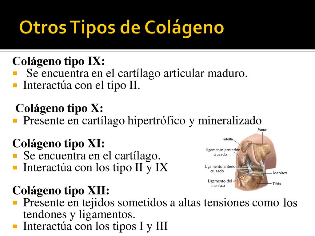 Colágeno tipo IX: Colágeno tipo XI: Colágeno tipo XII: