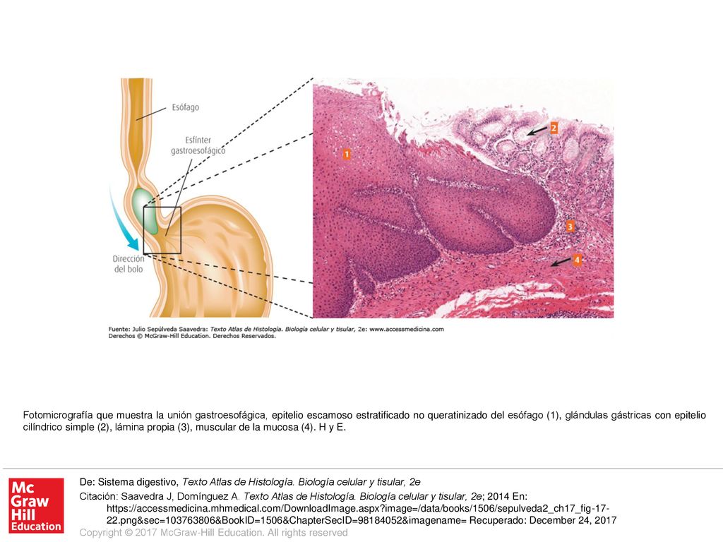 Fotomicrografía que muestra la unión gastroesofágica, epitelio escamoso estratificado no queratinizado del esófago (1), glándulas gástricas con epitelio cilíndrico simple (2), lámina propia (3), muscular de la mucosa (4). H y E.