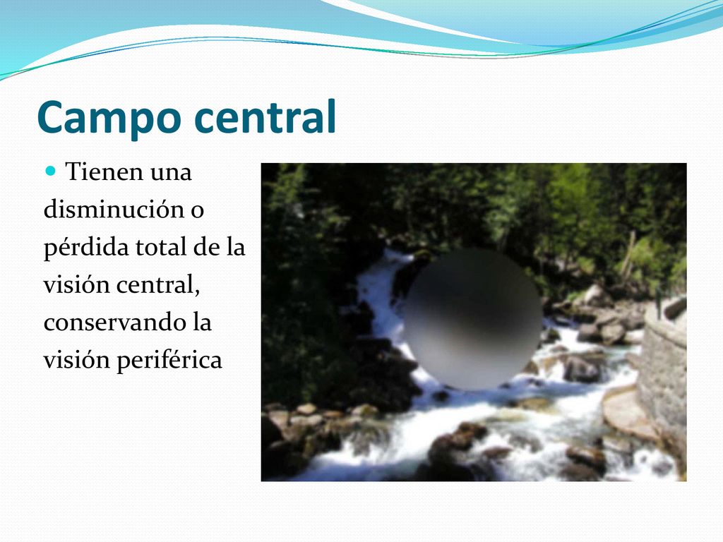 Campo central Tienen una disminución o pérdida total de la