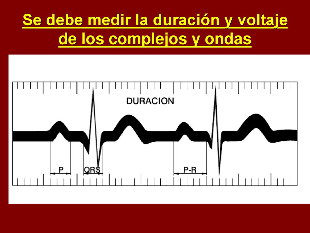 Se debe medir la duración y voltaje de los complejos y ondas