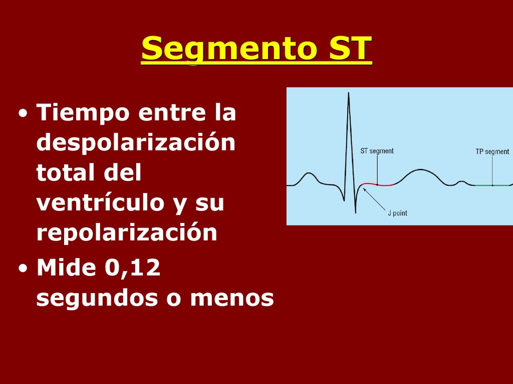 Segmento ST Tiempo entre la despolarización total del ventrículo y su repolarización.