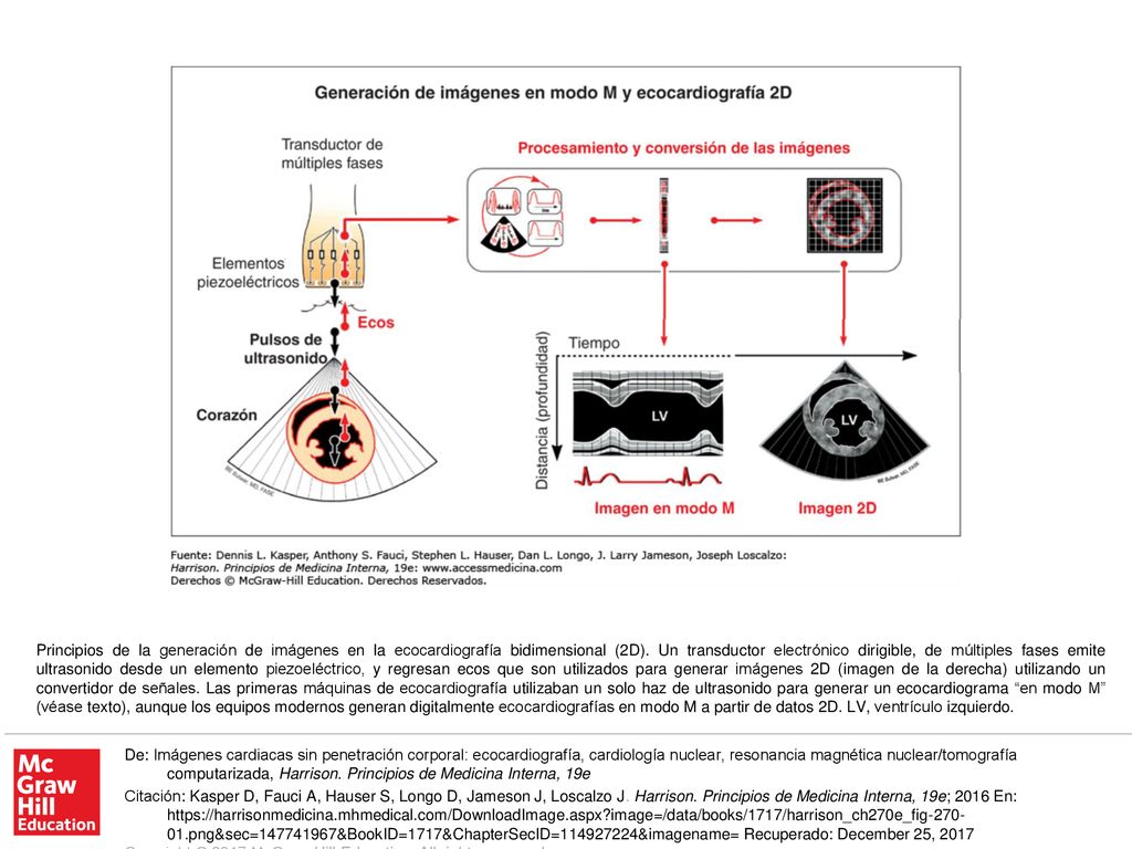 Principios de la generación de imágenes en la ecocardiografía bidimensional (2D). Un transductor electrónico dirigible, de múltiples fases emite ultrasonido desde un elemento piezoeléctrico, y regresan ecos que son utilizados para generar imágenes 2D (imagen de la derecha) utilizando un convertidor de señales. Las primeras máquinas de ecocardiografía utilizaban un solo haz de ultrasonido para generar un ecocardiograma en modo M (véase texto), aunque los equipos modernos generan digitalmente ecocardiografías en modo M a partir de datos 2D. LV, ventrículo izquierdo.