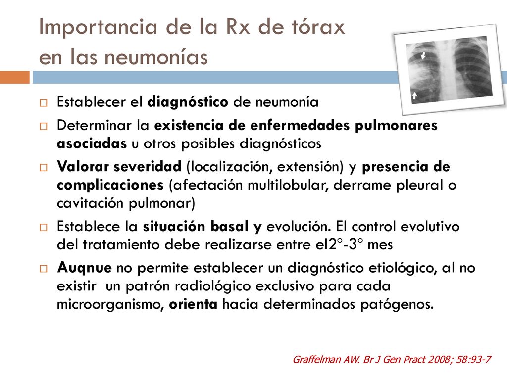 Importancia de la Rx de tórax en las neumonías