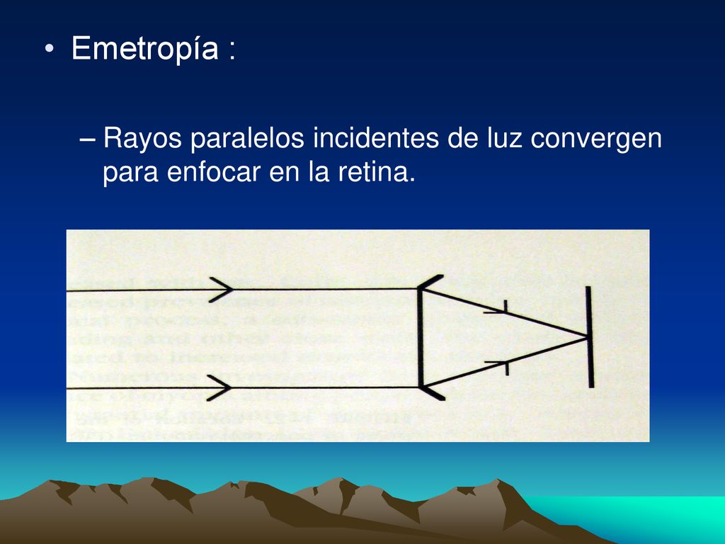 Emetropía : Rayos paralelos incidentes de luz convergen para enfocar en la retina.