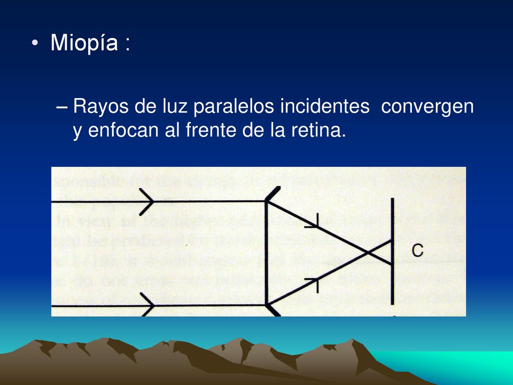 Miopía : Rayos de luz paralelos incidentes convergen y enfocan al frente de la retina.