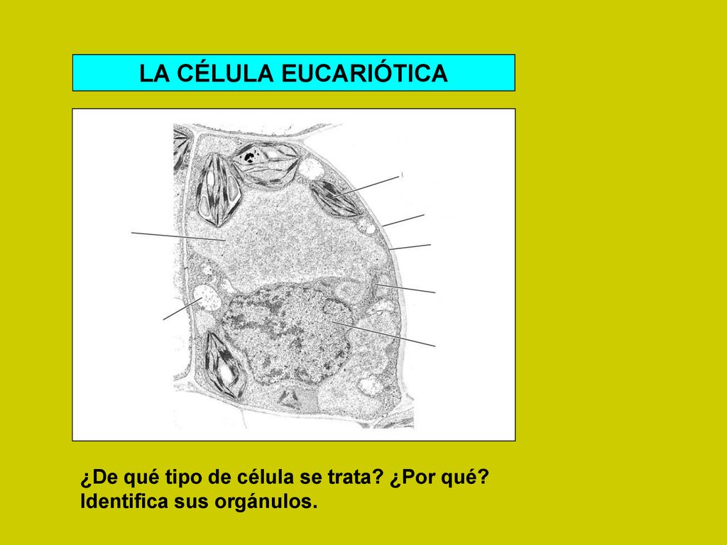 LA CÉLULA EUCARIÓTICA ¿De qué tipo de célula se trata ¿Por qué
