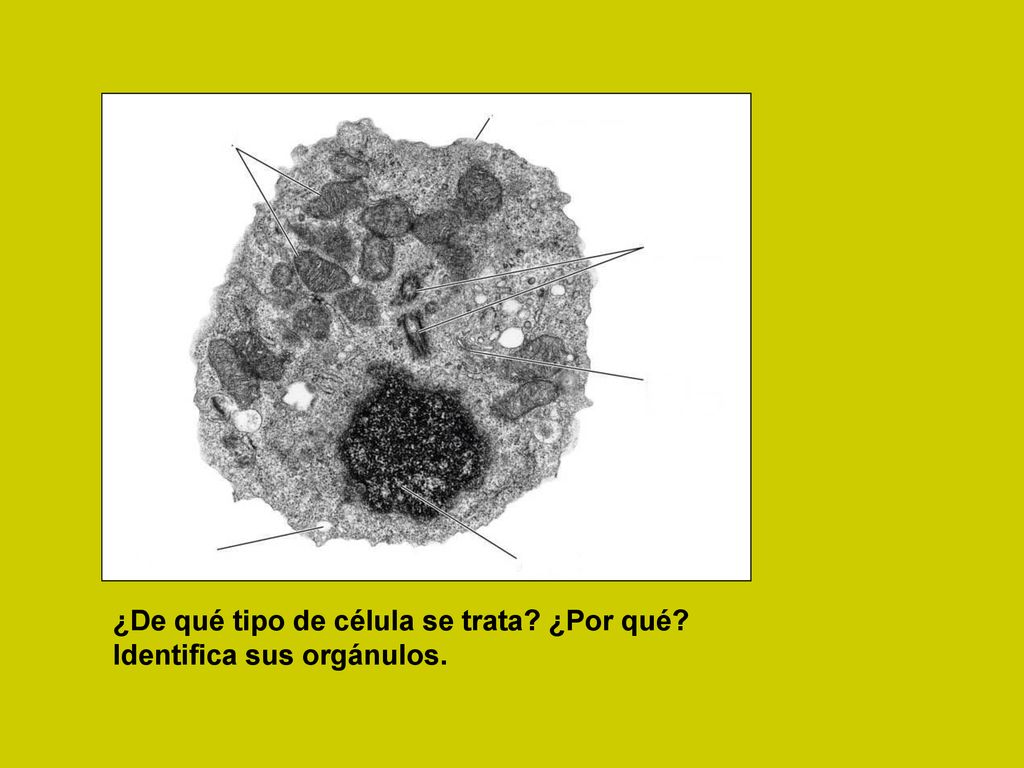 ¿De qué tipo de célula se trata ¿Por qué