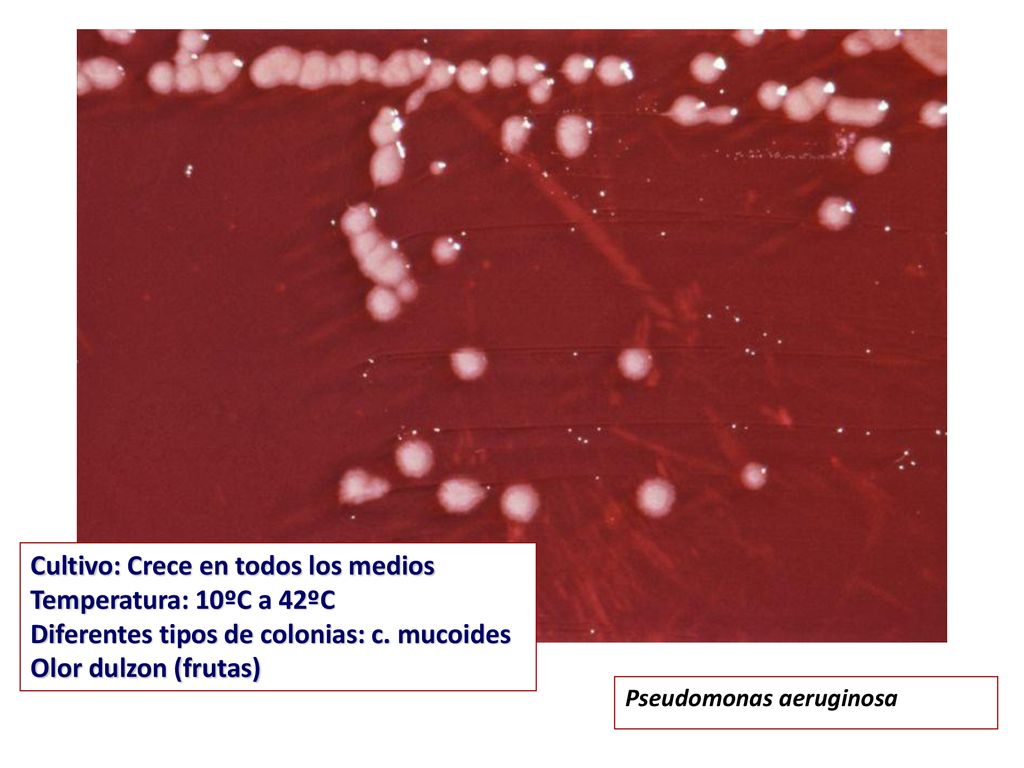 Cultivo: Crece en todos los medios Temperatura: 10ºC a 42ºC