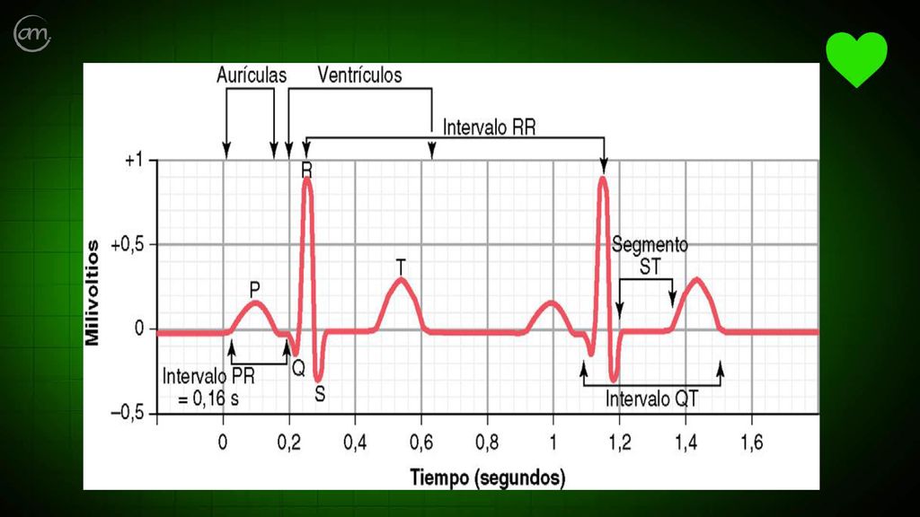 De la corriente eléctrica del impulso cardiaco se puede registrar sus potenciales eléctricos, si se colocan electrodos en la piel en lados opuestos del corazón. Electrocardiograma es el registro de los potenciales eléctricos del impulso cardiaco, cuando se colocan electrodos en la piel cercanos y alrededor del corazón. El Electrocardiograma normal presenta las siguientes ondas principales: