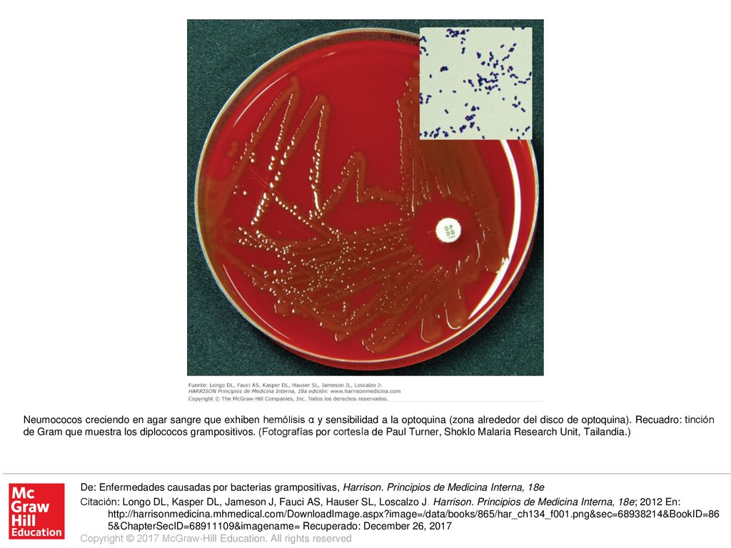 Neumococos creciendo en agar sangre que exhiben hemólisis α y sensibilidad a la optoquina (zona alrededor del disco de optoquina). Recuadro: tinción de Gram que muestra los diplococos grampositivos. (Fotografías por cortesía de Paul Turner, Shoklo Malaria Research Unit, Tailandia.)