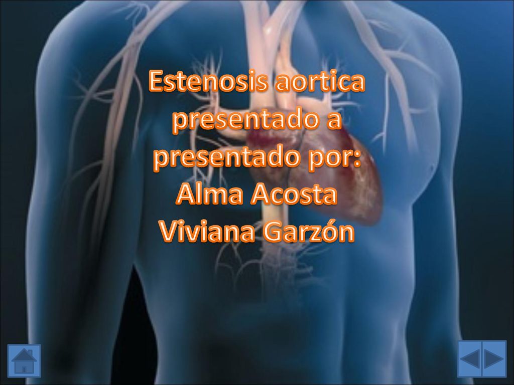 Estenosis aortica presentado a presentado por: Alma Acosta Viviana Garzón