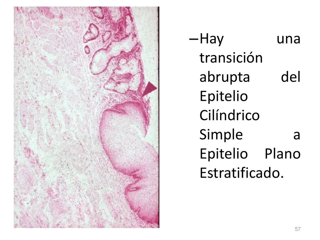 Hay una transición abrupta del Epitelio Cilíndrico Simple a Epitelio Plano Estratificado.