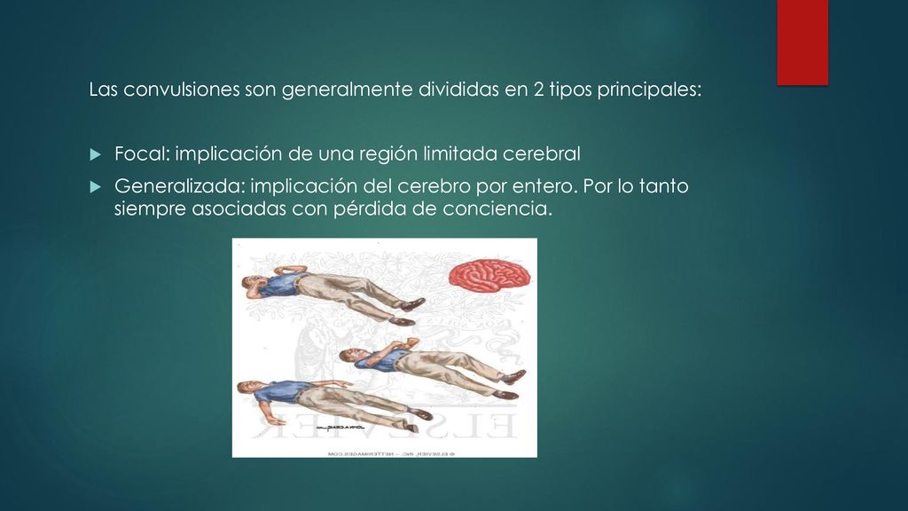Las convulsiones son generalmente divididas en 2 tipos principales: