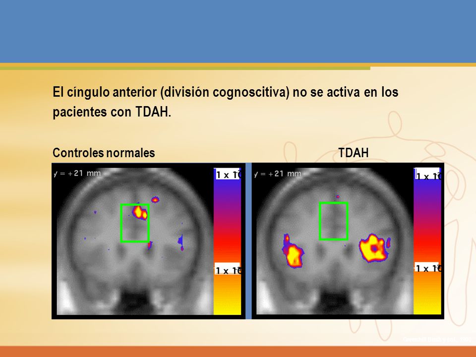 El cíngulo anterior (división cognoscitiva) no se activa en los
