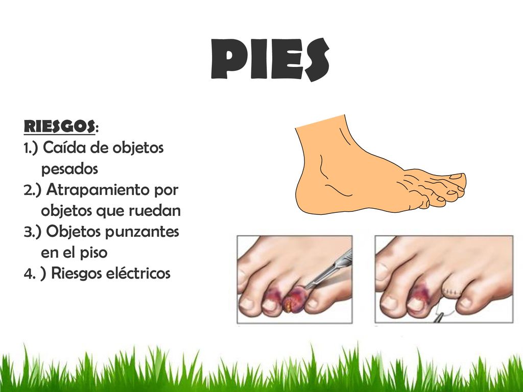 PIES Organice por secciones RIESGOS: 1.) Caída de objetos pesados