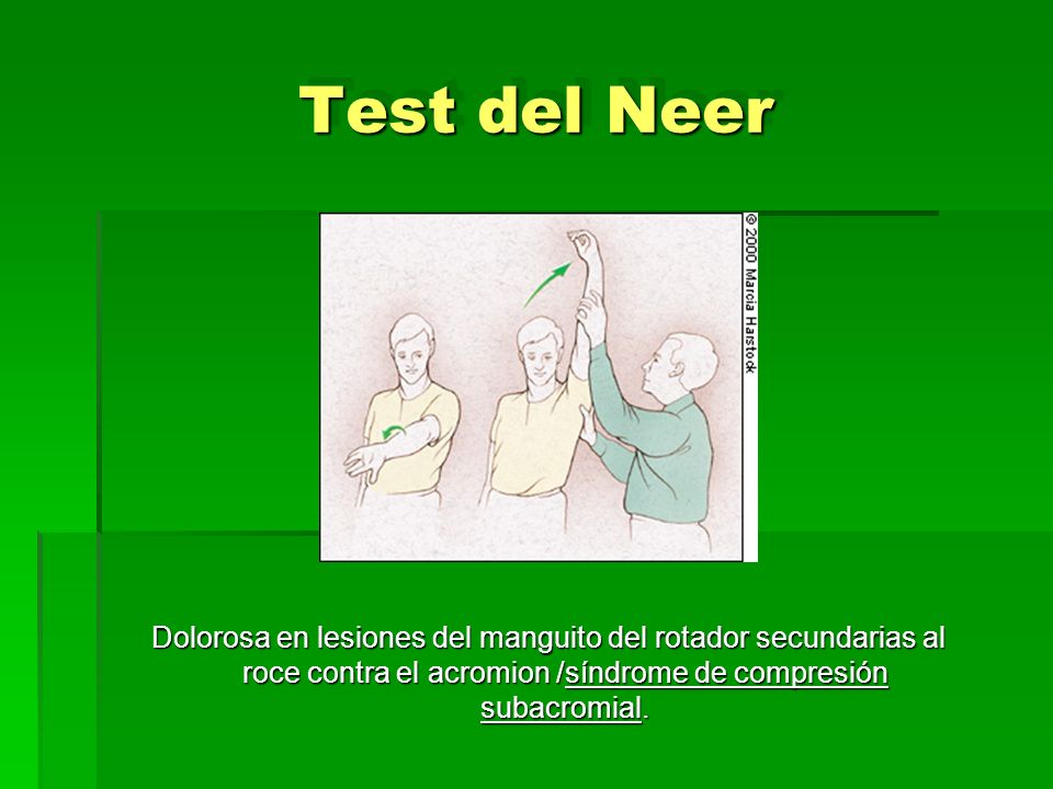 Test del Neer Dolorosa en lesiones del manguito del rotador secundarias al roce contra el acromion /síndrome de compresión subacromial.