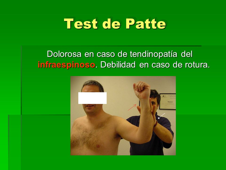 Test de Patte Dolorosa en caso de tendinopatía del infraespinoso. Debilidad en caso de rotura.