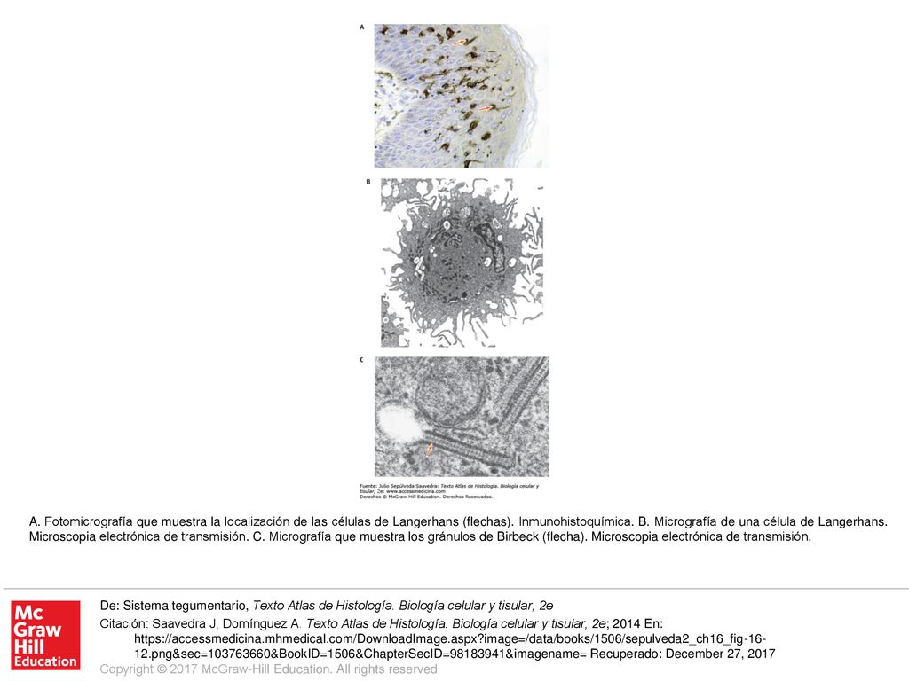 A. Fotomicrografía que muestra la localización de las células de Langerhans (flechas). Inmunohistoquímica. B. Micrografía de una célula de Langerhans. Microscopia electrónica de transmisión. C. Micrografía que muestra los gránulos de Birbeck (flecha). Microscopia electrónica de transmisión.