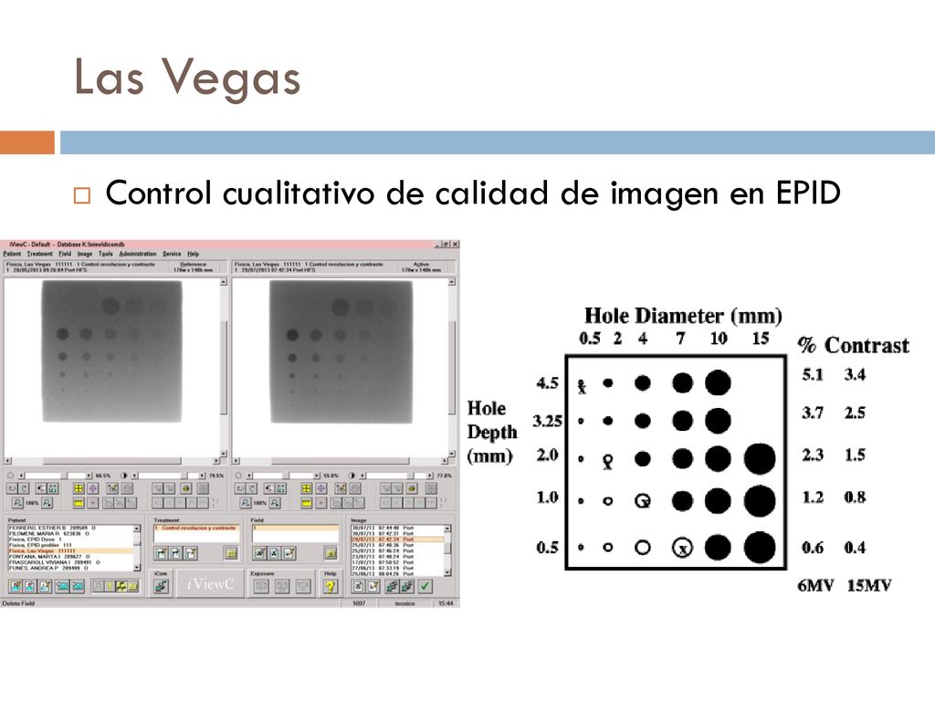 Las Vegas Control cualitativo de calidad de imagen en EPID
