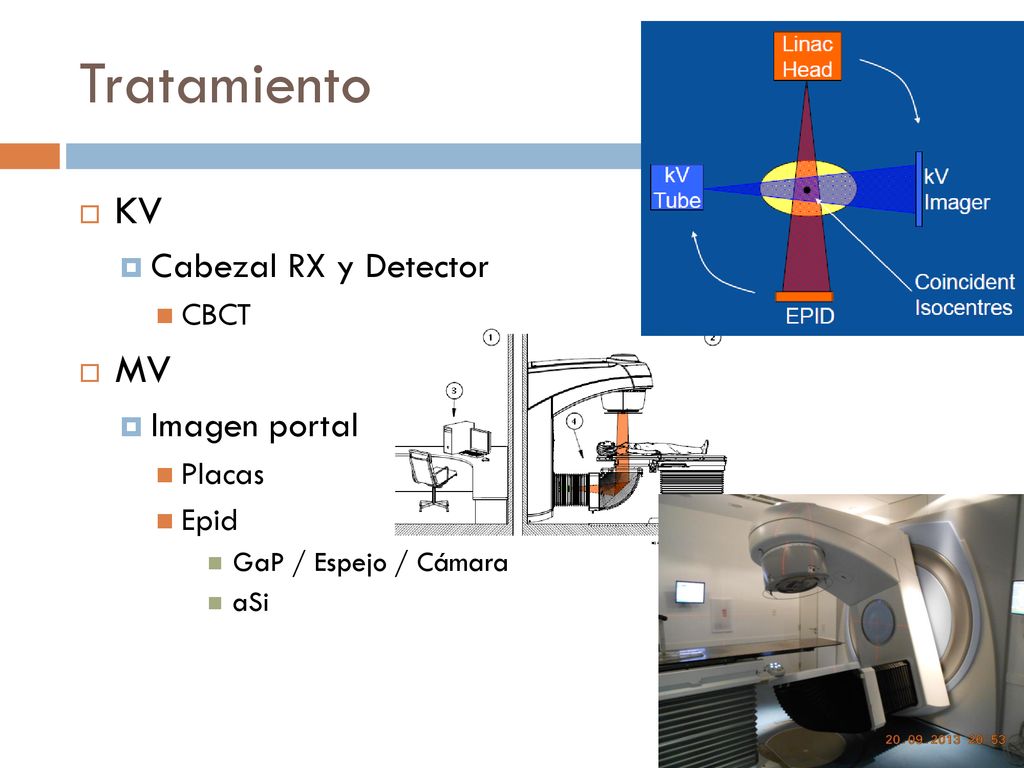Tratamiento KV MV Cabezal RX y Detector Imagen portal CBCT Placas Epid