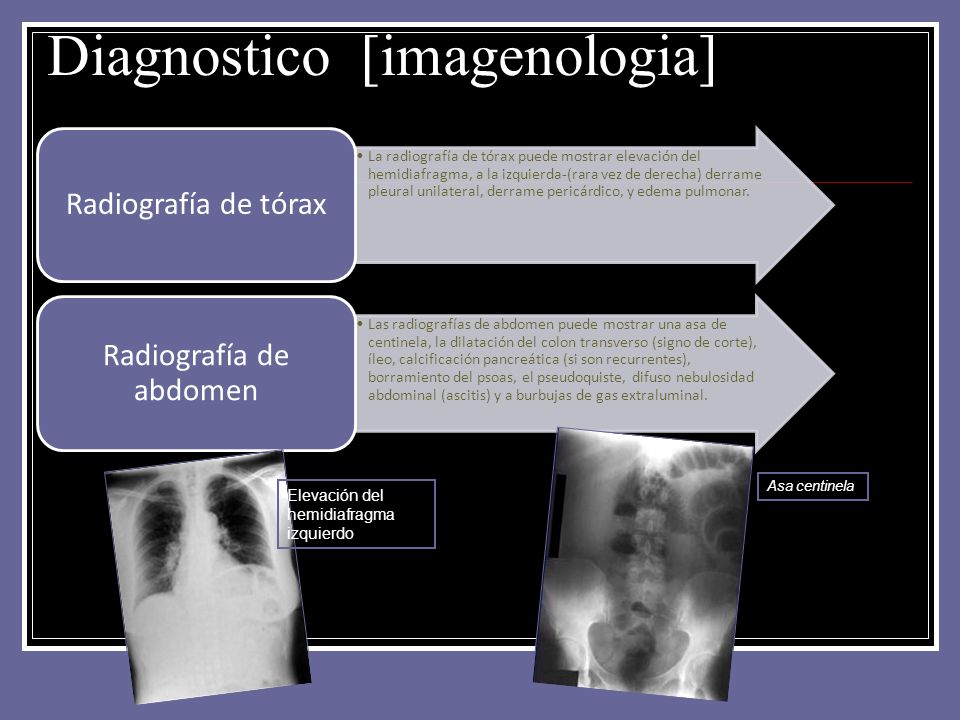 Diagnostico [imagenologia]