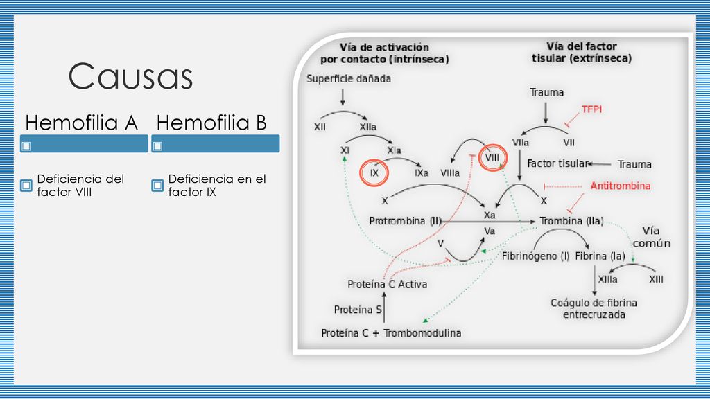 Causas Hemofilia A Hemofilia B Deficiencia del factor VIII