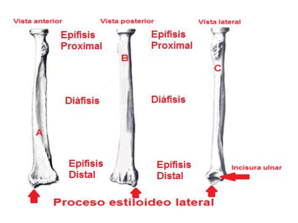Como usted puede ver tenemos en esta diapositiva la ilustración de un hueso llamado radio, es un hueso que se clasifica como largo, que forma parte de los huesos del antebrazo, junto con la ulna o cúbito, cuando su paciente está en posición anatómica este se sitúa en la zona radial o externa del antebrazo, tiene una epífisis proximal, una epífisis distal y una diáfisis, en este caso nos toma el interés la epífisis distal, la cual es gruesa y ancha en el plano frontal, su cara anterior es lisa y en su cara posterior hay pequeñas crestas que separan los surcos unos de otros y en estos surcos se encuentran los tendones de los músculos, su periferia externa se continúa con el proceso estiloideo del radio, en la cara interna se encuentra la incisura ulnar con una cara articular para unirse a la semicircunferencia de la cabeza de la ulna