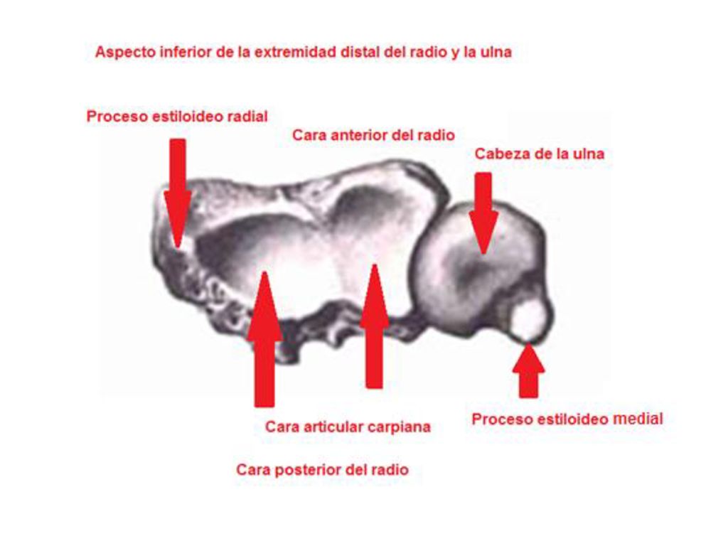 En esta diapositiva se muestra la cara inferior de la epífisis distal del radio, esta es cóncava en dirección transversal y anteroposterior, la zona donde se articula con los huesos de la primera fila del carpo, se denomina cara articular carpiana, esta cara articular carpiana está dividida por una pequeña cresta que se dispone en dirección anteroposterior y divide a la cara articular carpiana en dos partes para que se articulen los dos huesos del carpo correspondientes que son: las caras articulares ligeramente convexas del escafoides y semilunar, el triquetro se articula con el disco o cartílago articular triangular que representa una lámina fibrocartilaginosa que se inserta por uno de sus bordes en la incisura ulnar del radio y por su vértice en el proceso estiloideo de la ulna, este disco separa la cavidad de la articulación radioulnar distal de la cavidad de la articulación radiocarpiana
