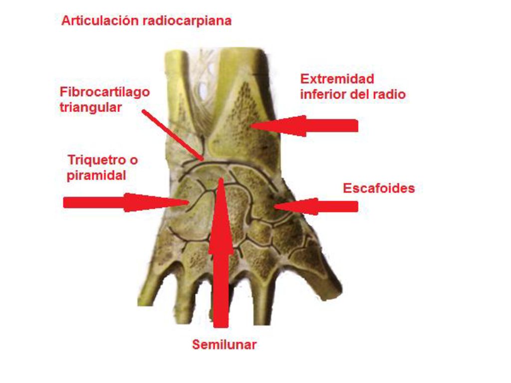 La articulación radiocarpiana por su estructura es una articulación sinovial, sus caras articulares la constituyen la cara articular carpiana del radio y el disco articular con la cabeza articular de la ulna, y las caras proximales de los huesos de la primera fila del carpo (escafoides, semilunar y triquetro o piramidal), la cavidad articular, se encuentra en correspondencia a la posición y dirección de las caras articulares, los medios de unión lo constituyen, la cápsula articular, reforzada por los ligamentos: ligamento colateral carporadial, ligamento colateral carpoulonar, ligamento radiocarpiano dorsal, ligamento radiocarpiano palmar, su clasificación es: por el número de caras articulares: compuesta, por la forma de las caras: elipsoidea, por el número de ejes de movimiento: biaxil, por su función en los ejes y movimientos: en el eje sagital: abducción y adducción, en el eje frontal: flexión y extensión, esta articulación como puede usted ver realiza los cuatro movimientos angulares y la sumatoria de los cuatro movimientos angulares permite que la articulación realice movimientos de circunducción