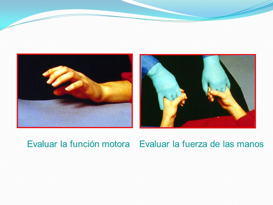 Evaluar la función motora Evaluar la fuerza de las manos