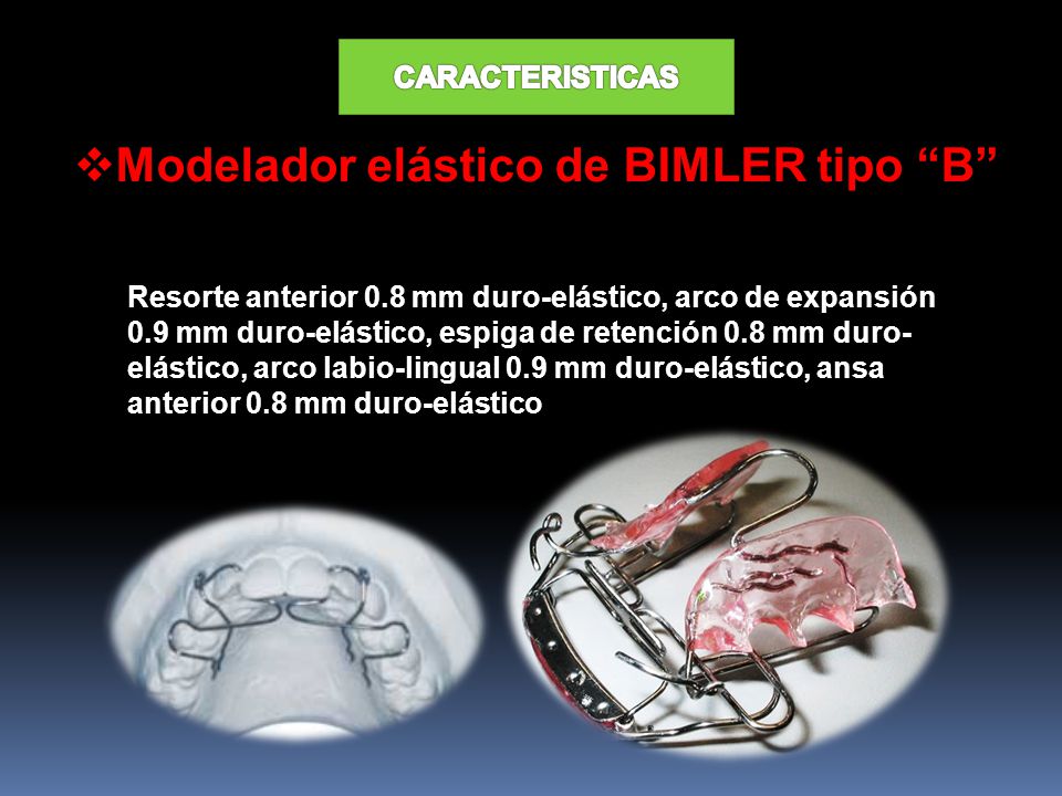 Modelador elástico de BIMLER tipo B