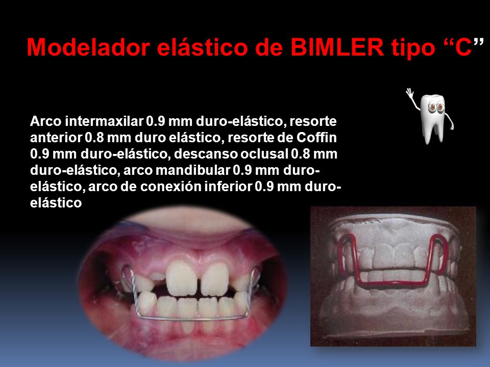 Modelador elástico de BIMLER tipo C