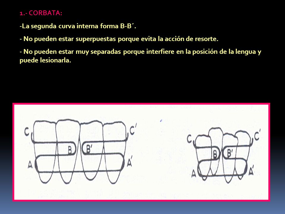 1.- CORBATA: La segunda curva interna forma B-B´. No pueden estar superpuestas porque evita la acción de resorte.