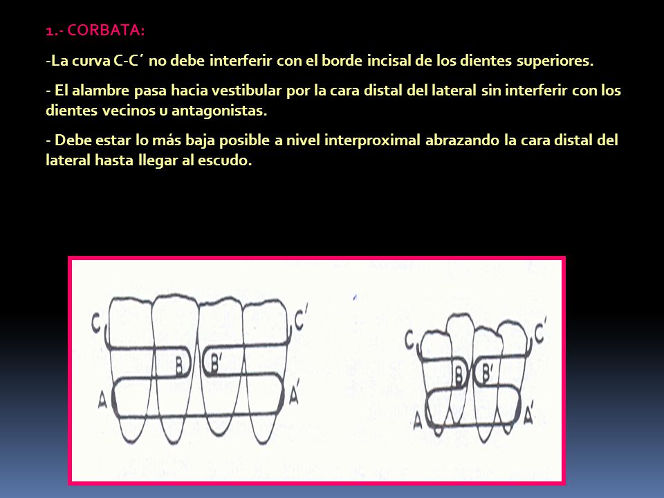 1.- CORBATA: La curva C-C´ no debe interferir con el borde incisal de los dientes superiores.