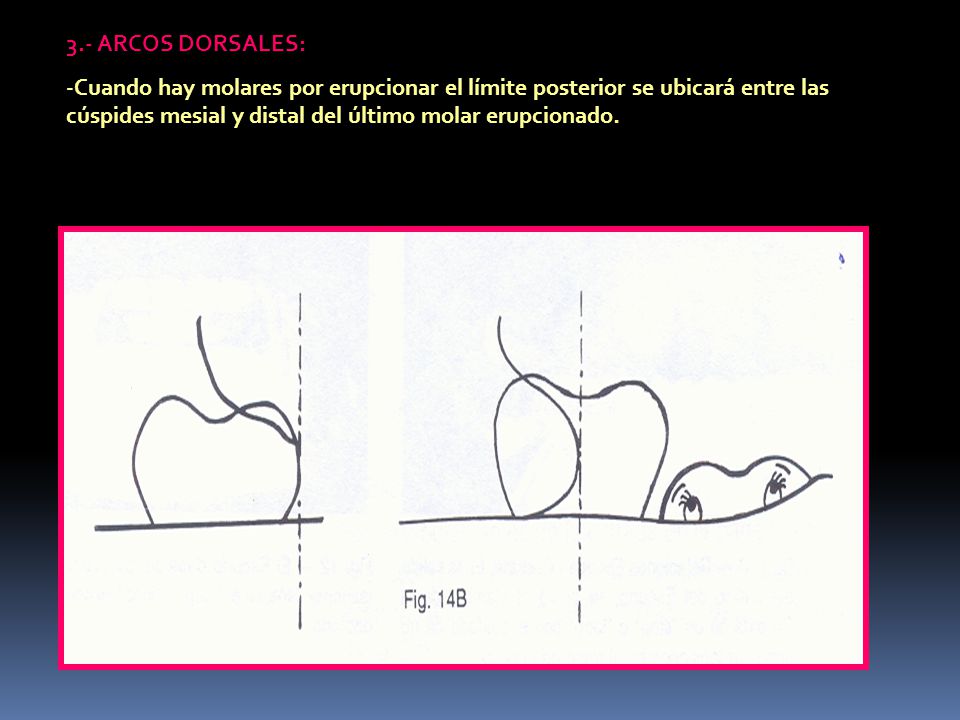 3.- ARCOS DORSALES: Cuando hay molares por erupcionar el límite posterior se ubicará entre las cúspides mesial y distal del último molar erupcionado.
