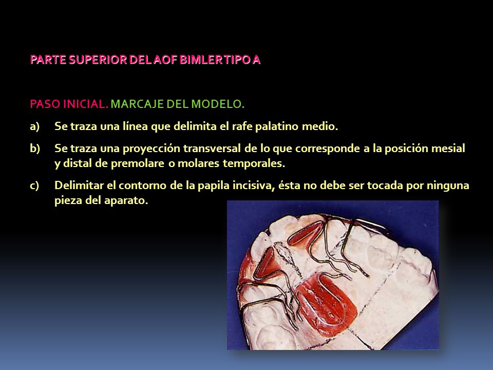 PARTE SUPERIOR DEL AOF BIMLER TIPO A