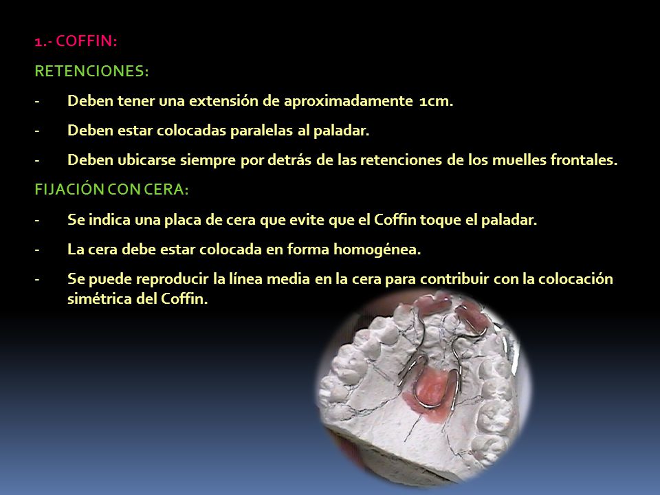 1.- COFFIN: RETENCIONES: Deben tener una extensión de aproximadamente 1cm. Deben estar colocadas paralelas al paladar.