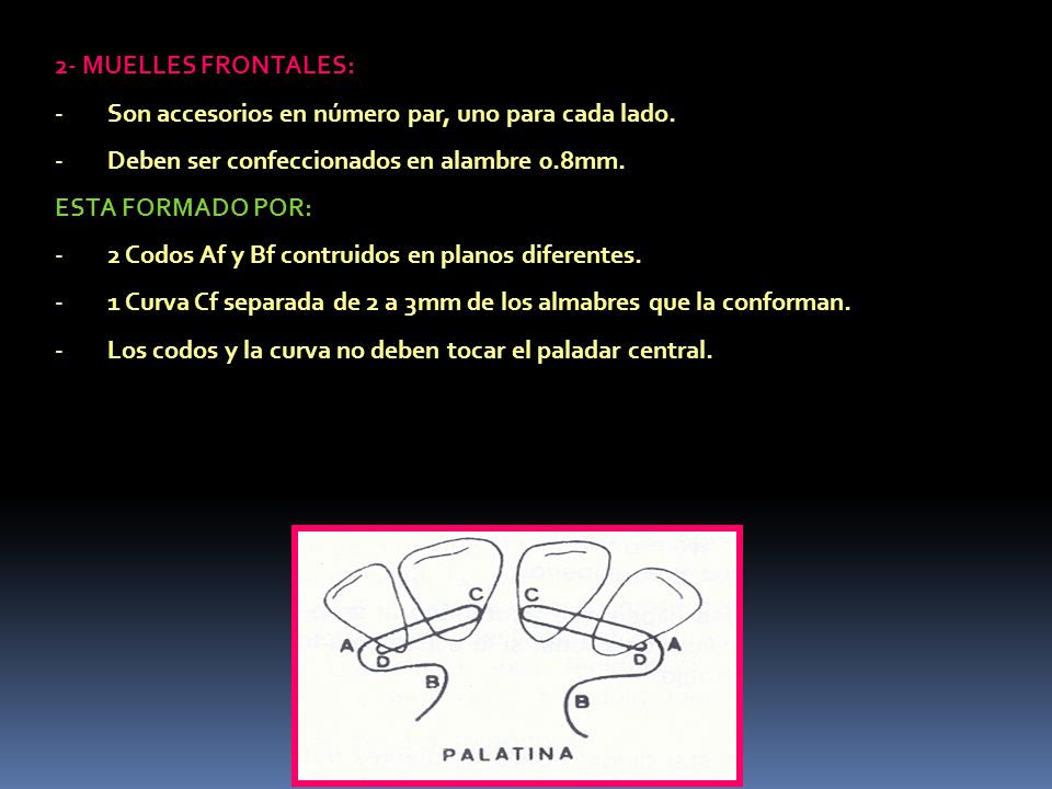 2- MUELLES FRONTALES: Son accesorios en número par, uno para cada lado. Deben ser confeccionados en alambre 0.8mm.