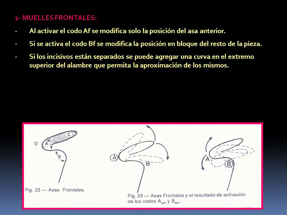 2- MUELLES FRONTALES: Al activar el codo Af se modifica solo la posición del asa anterior.