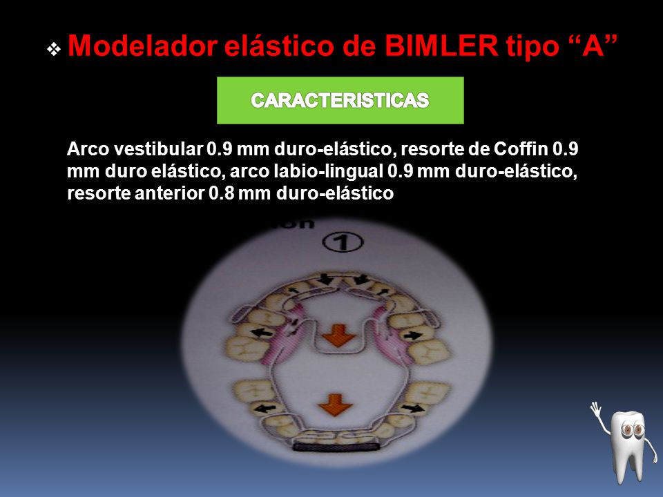 Modelador elástico de BIMLER tipo A