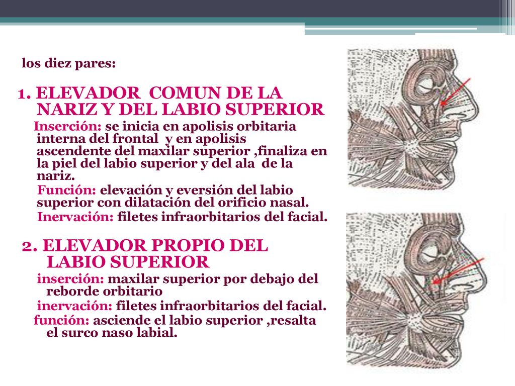 1. ELEVADOR COMUN DE LA NARIZ Y DEL LABIO SUPERIOR